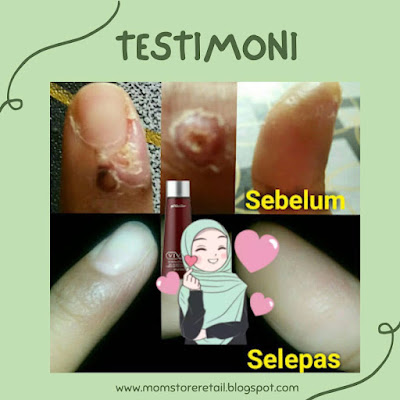 Testimoni Shaklee