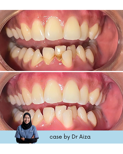 Rawatan Gigi di Klinik Pergigian Redha