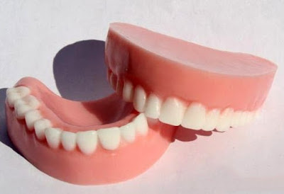 Răng giả tháo lắp nhựa dẻo là thế nào vậy?-2