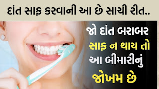 દાંતની સફાઈ માટે બ્રશ જ નથી બેસ્ટ ઉપાય, જો દાંત બરાબર સાફ ન થાય તો આ બીમારીનું જોખમ છે