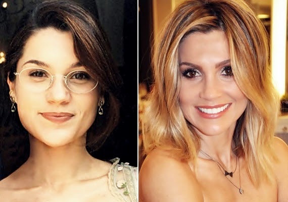 Veja o sorriso dos famosos antes e depois OsPaparazzi
