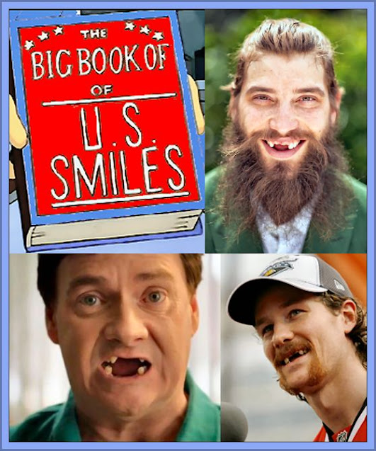 Big Book Of US Book Of Smiles - Fact: 1 in 5 US pensioners Have No Teeth