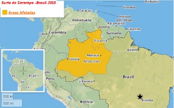 Um surto de sarampo está afetando os estados do Amazonas e Roraima