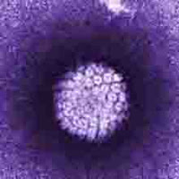 <Img src ="foto-virus-VPH.jpg" width = "220" height "220" border = "0" alt = "Partícula viral del VPH">