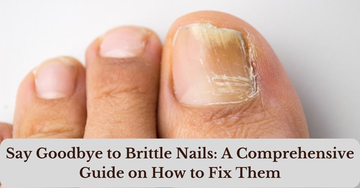 Brittle Nails: Causes, Treatment, And Nutrition
