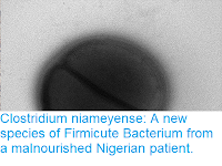 https://sciencythoughts.blogspot.com/2018/07/clostridium-niameyense-new-species-of.html