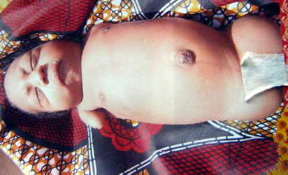 Baby Girl Without Hands And Legs Born In Bauchi
