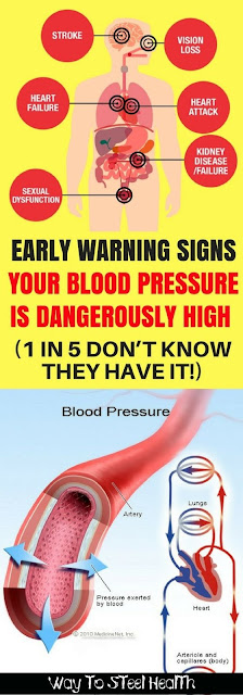 EARLY WARNING SIGNS YOUR BLOOD PRESSURE IS DANGEROUSLY HIGH (1 IN 5 DON’T KNOW THEY HAVE IT!)