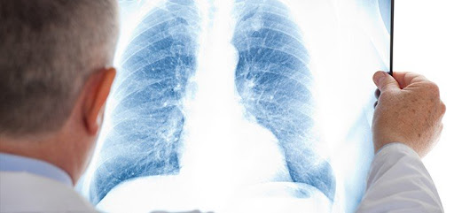 How is mesothelioma diagnosed?