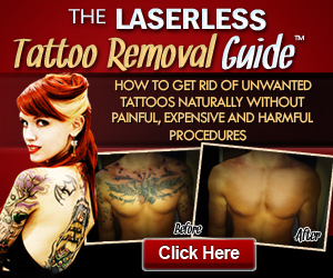  non laser tattoo removal solution 
