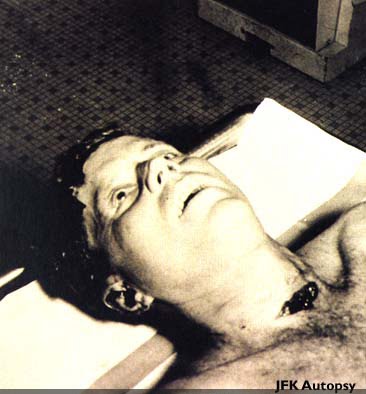 president kennedy autopsy. kennedy autopsy pictures.