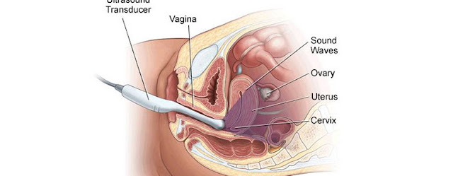 Ecografia Ginecologica