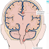 Images for Hernia of the Brain and its types.