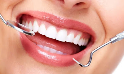 11 Cara Merawat Gigi yang Benar dan Gambar Gigi Putih Bersih