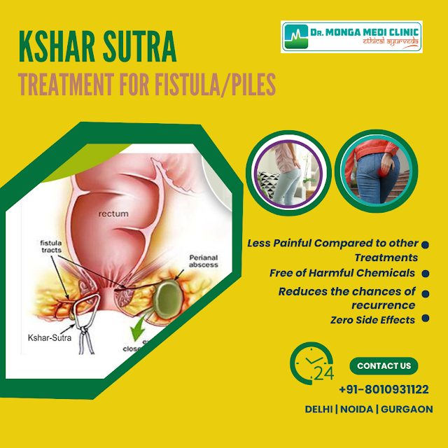 Kshar Sutra Treatment Without Surgery