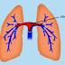 What is Saddle Pulmonary Embolism - Definition, Symptoms, Causes, Treatment