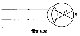 Solutions Class 12 भौतिकी विज्ञान-I Chapter-9 (किरण प्रकाशिकी एवं प्रकाशिक यंत्र)