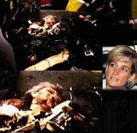 Princess Diana Accident