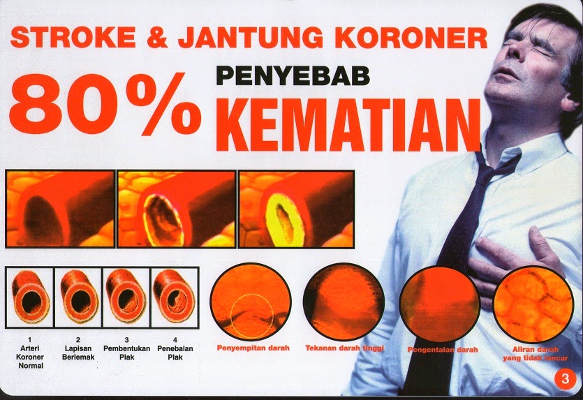 Jantung Koroner dan Stroke