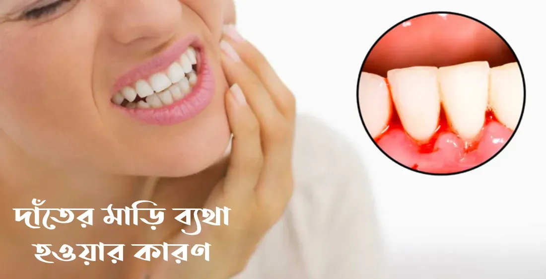 দাঁতের মাড়ি ব্যথা হওয়ার কারণ দাঁতের মাড়ি ব্যথা হওয়ার কারণ