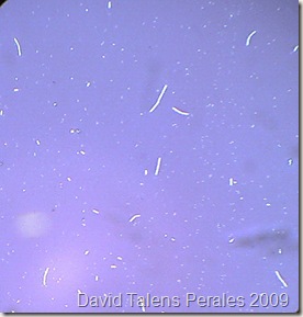 Bacillus sp. tinción negativa