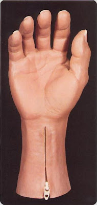 hand prosthesis