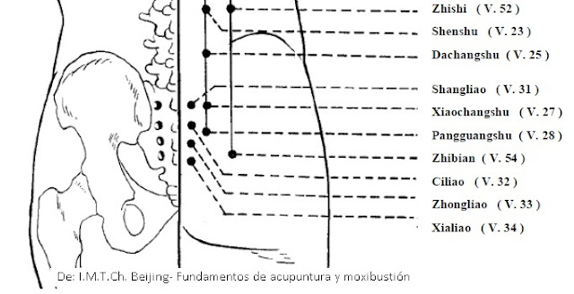 puntos de acupuntura para ciática lumbalgia