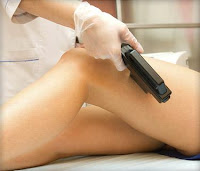 Laser Hair Removal Bangalore