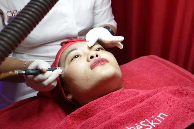 Silkpeel elsheskin clinic