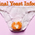 Vaginal Yeast Infection - Symptoms, Causes & Treatment - OnMyHealth
