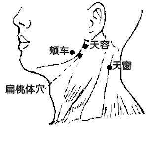 扁桃體穴位 | 扁桃體穴痛位置 - 穴道按摩經絡圖解 | Source:zhongyibaike.com