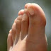 Saiba a importância dos cuidados com os pés, principalmente para diabéticos
