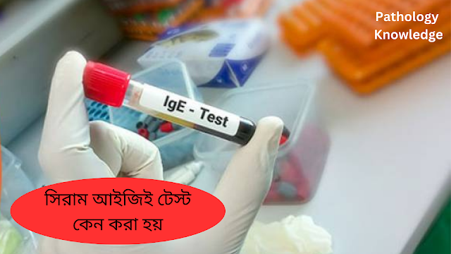 সিরাম আইজিই টেস্ট কেন করা হয়