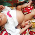 Nigeria Woman Gives Birth To Baby With 4 Legs, 2 Genital ─ Umahiprince’sblog