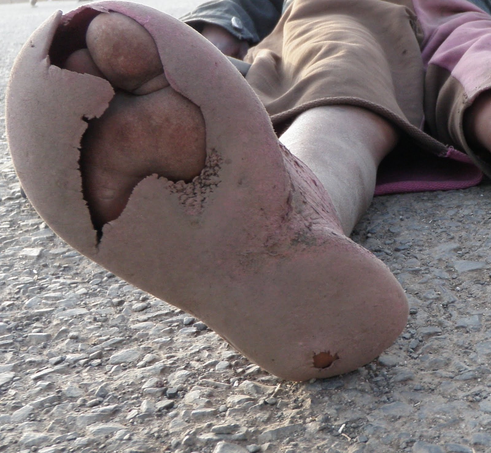 ... kids at the care-points, who consider a pair of shoes to be a luxury