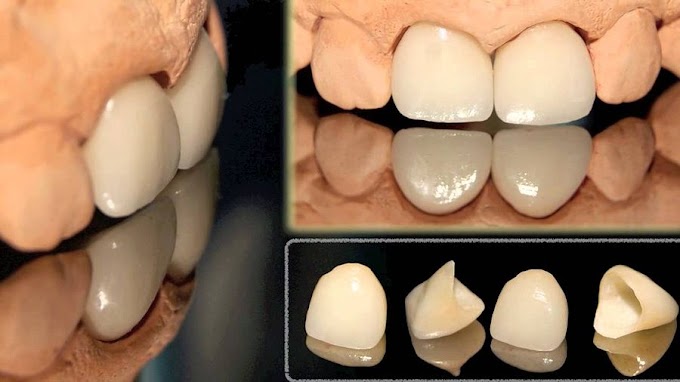 La Odontología Biomimética y sus 5 objetivos que debemos tener en cuenta