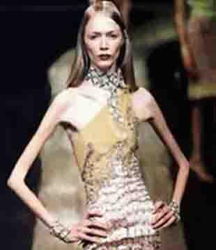 ISABELLE CARO French model died from Anorexia nervosa she was 28