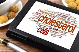 30 Cara Menurunkan Kadar Kolesterol Tinggi (Alami, Terapi & Obat)