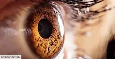 eye floaters and their causes