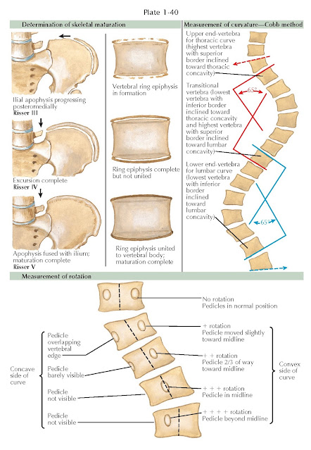 DETERMINATION OF SKELETAL MATURATION, MEASUREMENT OF CURVATURE, AND MEASUREMENT OF ROTATION