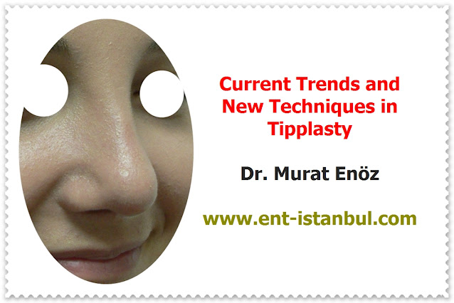 Patient Selection for Tipplasty - Current Concepts in Nasal Tip Plasty - How to Create Natural Nasal Tip? - Creating A Natural-Appearing Nasal Tip Contour - Nose Tip Plasty in Istanbul - Nose Tip Plasty in Turkey