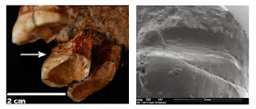 Neanderthals used toothpicks to alleviate gum disease