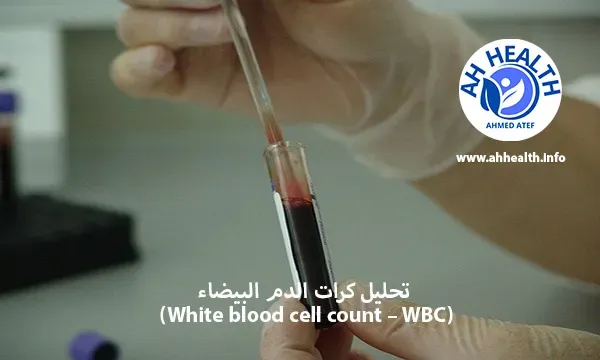 تحليل كرات الدم البيضاء  (White blood cell count – WBC)