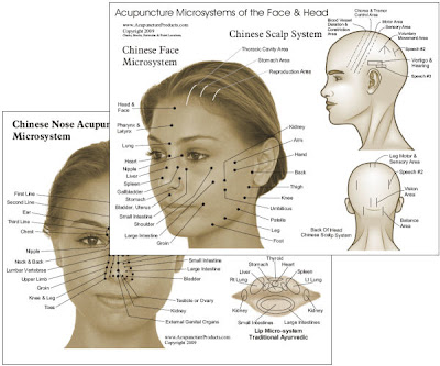 Acupuncture visage