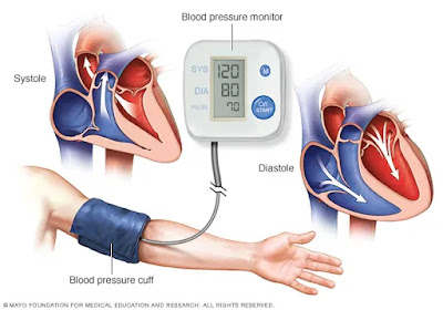 What is high blood pressure, symptoms and treatment