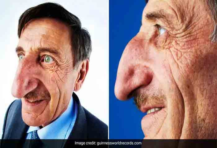 News, World-News, World, Obituary-News, World Record, GWR, Guinness, Obituary, Mehmet Ozyurek, Man With World's Longest Nose, Dies At 75.
