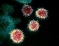 Coronavirus across countries and the UK
