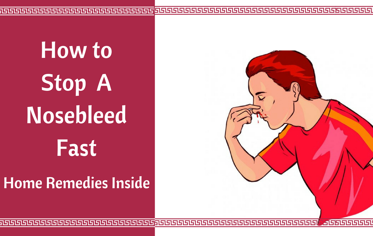 How To Stop A Nosebleed Fast Permanently Home Remedies