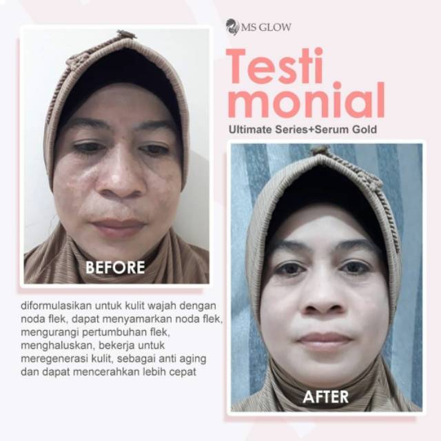 MS Glow Skincare untuk Usia 50 Tahun Keatas