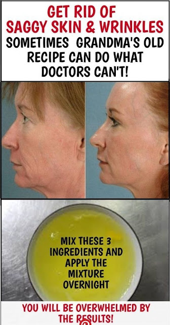 Grandma’s Home Remedy To Get Rid Of Saggy Skin And Wrinkles